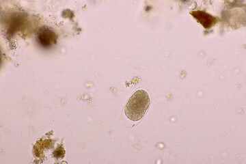 Egg of Hookworm in human stool, analyze by microscope, original magnification 400x