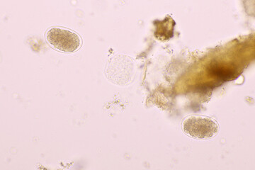 Egg of Hookworm in human stool, analyze by microscope, original magnification 400x