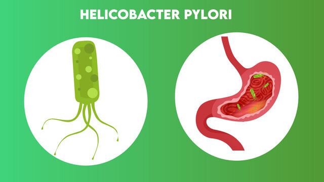 HELICOBACTER PYLORI