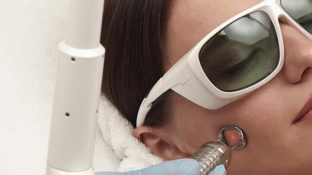 Close-up Of Laser Theraphy On Woman Forehead