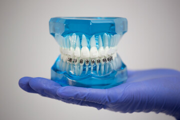 Dental examinations, dental cleaning systems, with braces, shows the dentist
