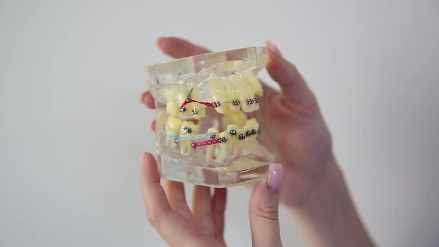 Dental examinations, dental cleaning systems, with braces, shows the dentist