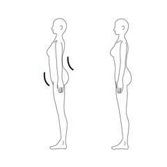 女性　メディカル　姿勢（反り腰） 美容　裸　ヌード　全身　横