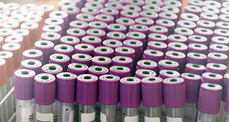 Obraz premium Closeup view of blank plastic blood tube, blurred background.