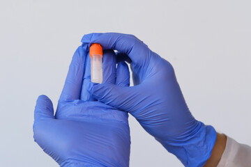woman holding a kit for scraping the epithelium for dna test, collecting a genetic sample for...