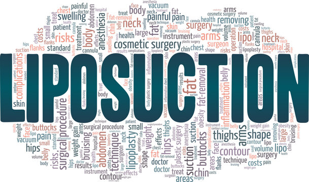 Liposuction vector illustration word cloud isolated on a white background.