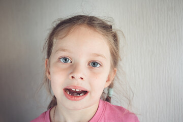 first baby teeth that fell out, portrait of a girl with her front teeth that fell out, children's dentistry