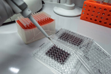 plastic plates for cell cultures