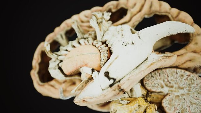 medical anotomy of real human brain
