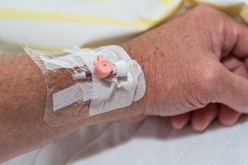 Venflon - Kanüle für Infusion