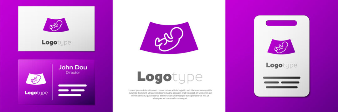 Logotype Ultrasound of baby icon isolated on white background. Fetus. Logo design template element. Vector.