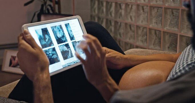 Young lovely couple watching ultrasound image of future child on electronic tablet at home. Concept of family, birth, life, love, gental parenthood. Close up