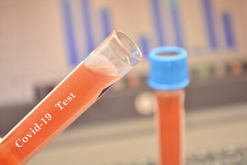 test vaccino per coronavirus in laboratorio medico scientifico provette reagenti medici