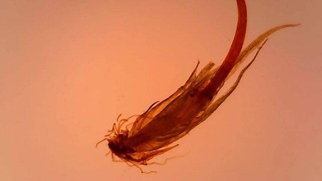 Microscope Polytrichum Whole Mount x1200