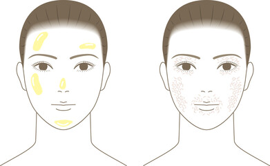 脂性肌と乾燥肌の女性の顔