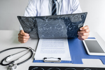 Doctor hands holding patient brain x-ray film before treatment and analyzing treat method