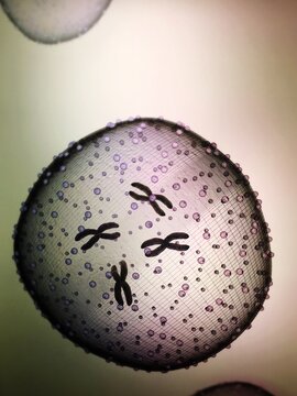 Yeast Cell Seen Through Microscope