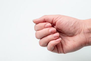 Close-up of Caucasian female hand with natural unpolished nails, overgrown cuticle on white background, top view