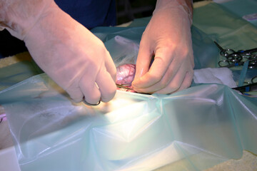 Two hand of a surgeon performimg surgery