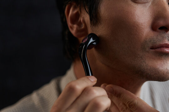 Closeup beard growth treatment