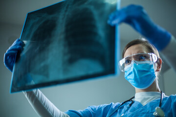 Female pulmonologist or oncologist holding chest X-ray scan,inspecting COVID-19 patient...