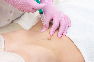 lipolytic injections are placed in the stomach. female hands in pink gloves inject a young woman...