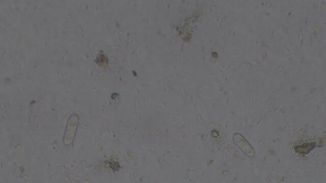 Microscopy of Coccidia organisms in a rabbit feces. Parasite (Eimeria species) in a form of Oocysts. These organisms live in rabbit intestines and can infect the liver. 