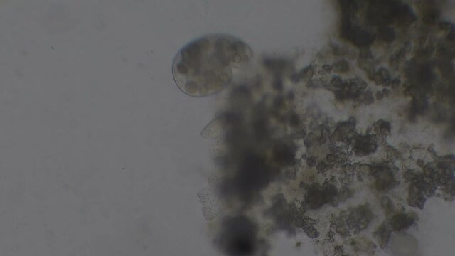 Microscopy of protozoa microorganisms in the water sample, showing ciliates, paramecium, bacteria, spirochaete and algae. Motion of single-celled animals under microscope. 