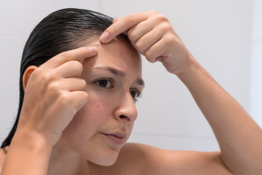 Close-up Portrait Of A Girl Squeezes Out A Pimple On Her Forehead. An Awkward Moment Before A Date