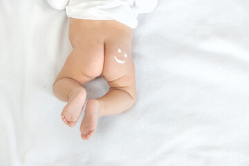 Smile sign on the baby's buttock with a cream. Selective focus.