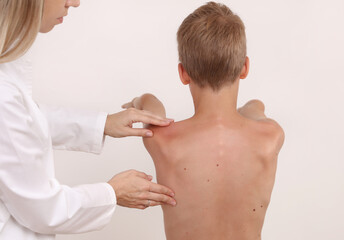 Physiotherapist exam for teenage boy. Manual Muscles Tests and Posture Checking . Preventive Health Care Visits in Children