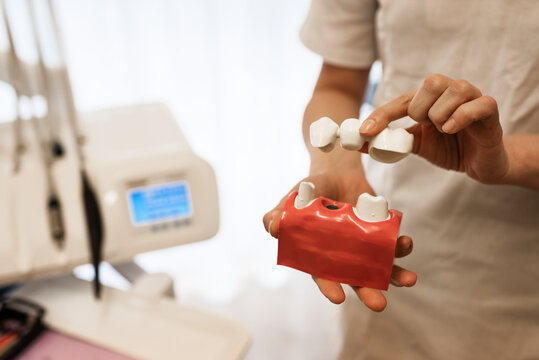 Dentist holding dental bridge model, Sweden
