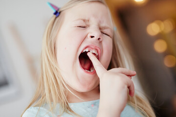 Girl moving milk tooth, Sweden