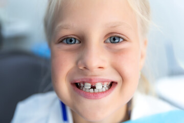 Little blond happy kid girl at dentist office smiling showing diastema overbite teeth missing gap. Child during orthodontist visit and oral cavity check-up. Children tooth care and hygiene