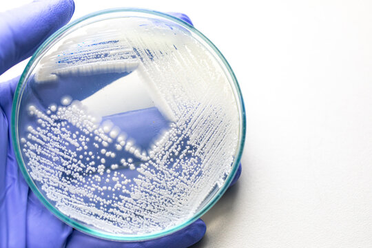 Pichia is a genus of yeasts in the family Saccharomycetaceae under the microscope for education.
