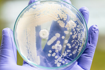 Pichia is a genus of yeasts in the family Saccharomycetaceae under the microscope for education.
