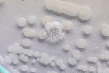 Pichia is a genus of yeasts in the family Saccharomycetaceae under the microscope for education.
