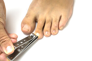 Cutting toenails. Pedicure. Broken toenail on white background.