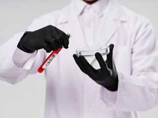 Blood test black gloves analyzes laboratory treatment