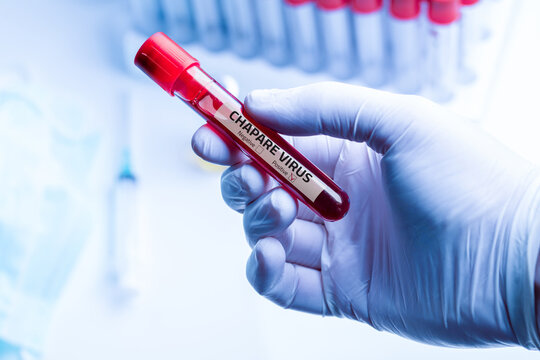 Nurse wearing respiratory mask holding a positive blood test result for Chapare Mammarenavirus