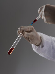 Blood test research diagnostics laboratory drug development