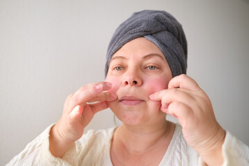 face of a European adult woman close up, wrinkles on the aging skin, makes a lifting massage with fingers, the concept of cosmetology, beauty