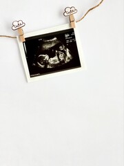Ultrasound scans of a pregnant woman hanging on a rope, wooden decorative pins with word «cute»