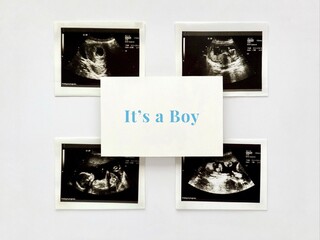 Ultrasound scans of a pregnant woman, white paper with text «It’s a boy»