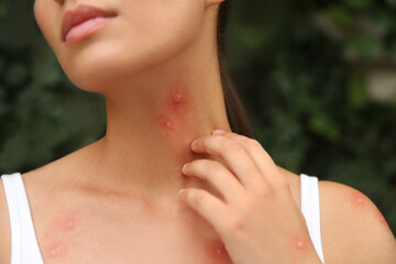 Woman scratching neck with insect bites outdoors, closeup