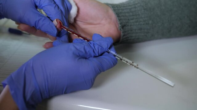 Doctor takes blood sample from a patient's finger using a capillary tube