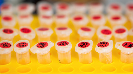 Test tubes ready for medical research and chemical analysis. Multiple flasks with red labels inside a yellow holder in pharmaceutical lab. Equipment for experiment.