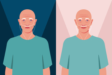 Bald senior man in the hospital. Old cancer patient with a nasal breathing tube. Health care for the elderly people. Coronavirus and respiratory therapy. Vector flat illustration