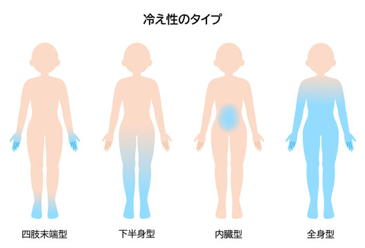 冷え性のタイプ　女性
