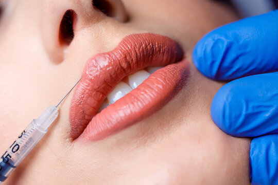 young woman gets injection of botox in her lips. Woman in beauty salon. plastic surgery clinic.